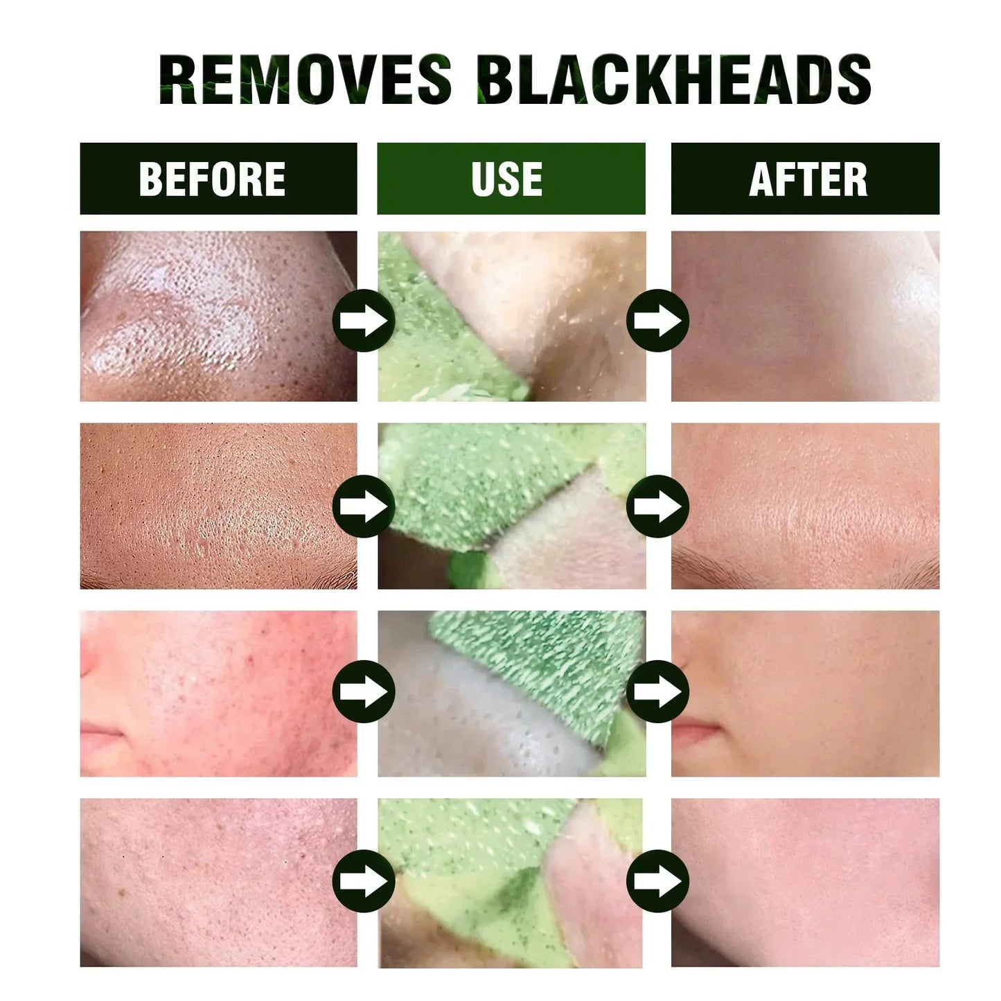 Green Tea Blackhead Remover Mask