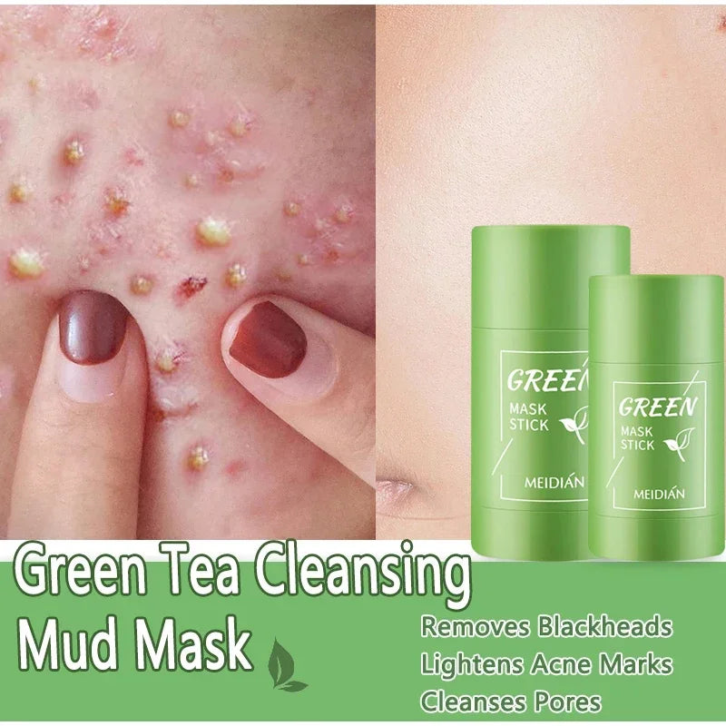 Green Tea Blackhead Remover Mask